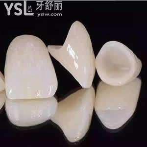 鄭州拜博口腔醫(yī)院價(jià)格表。全冠牙愛爾創(chuàng)全瓷牙價(jià)格超低大優(yōu)惠。