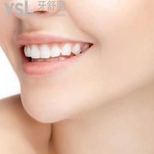 鄭州拜博口腔之牙齒美白實(shí)力巨惠，安排