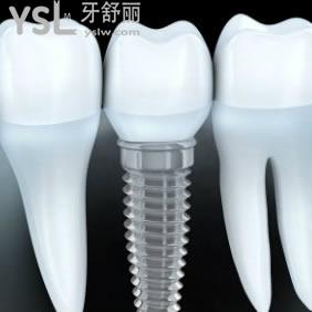 鄭州拜博口腔醫(yī)院價(jià)格表，韓國(guó)dentis種植牙驚爆價(jià)！