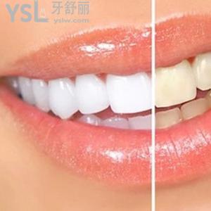 長沙口腔醫(yī)院哪家好？長沙好大夫之皓齒美白價格表收費一覽