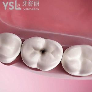 根管治療磨牙原價和現(xiàn)價各是多少？珠海九龍口腔醫(yī)院收費標(biāo)準(zhǔn)