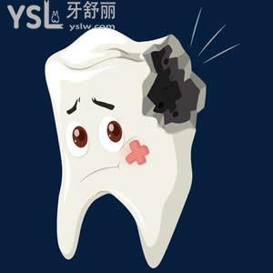 牙齒有洞可以直接拔掉么還是修復(fù)一下比較好？有專業(yè)的醫(yī)生解答嗎？