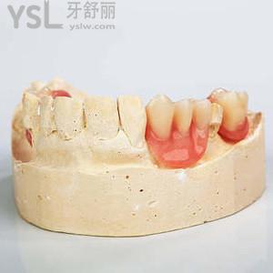 上假牙多少錢一顆？