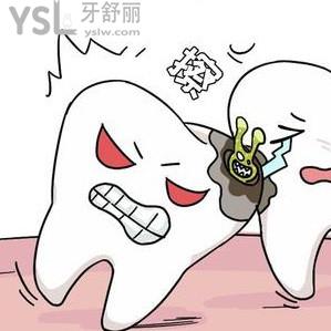 （拔牙后窟窿圖）智齒拔完后洞多久？