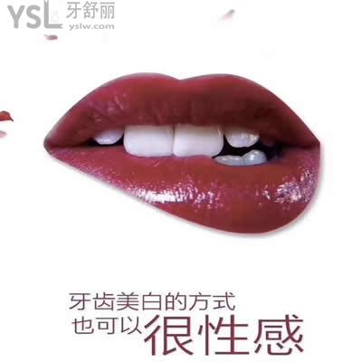 冰瓷牙貼面能維持多久？