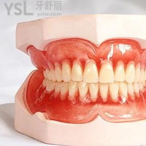 bps吸附性義齒價(jià)格貴嗎