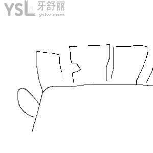 牙掉了一小塊怎么回事缺鈣嗎