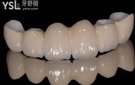 全瓷牙和二氧化鋯區(qū)有什么不一樣？