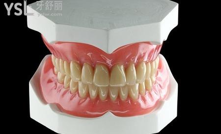 活動義齒修復(fù)過程是什么樣子的？