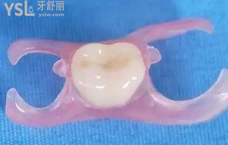 固定義齒的禁忌癥有哪些？