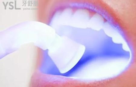 牙齒美白要多少錢？