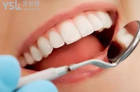 冷光美白牙齒需要注意什么？