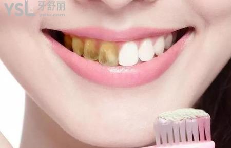 牙齒發(fā)黃怎么變白？