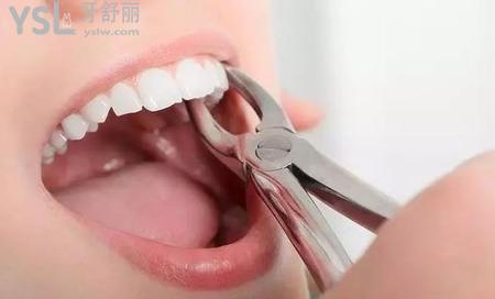拔完智齒臉會(huì)不會(huì)小？