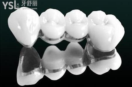 帶烤瓷牙能不能用電動(dòng)牙刷？