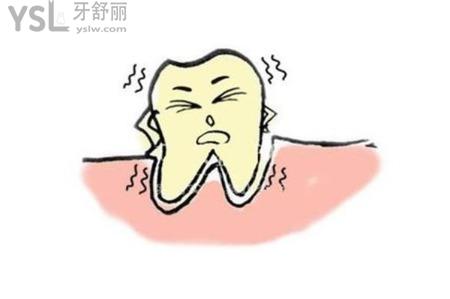 牙齒3度松動還能保嗎？