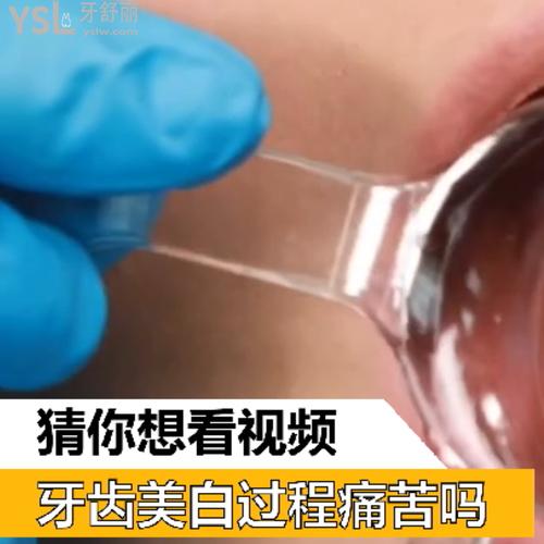 牙齒美白過程痛苦嗎？