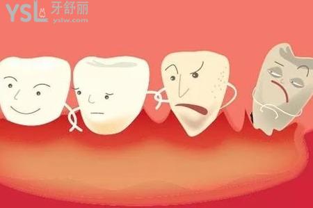 牙周病用什么牙膏好？