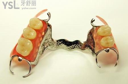 活動假牙和固定假牙哪個比較好？