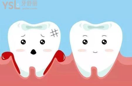 牙周炎引起的臉腫怎么辦？