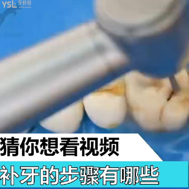 補(bǔ)牙的步驟有哪些？