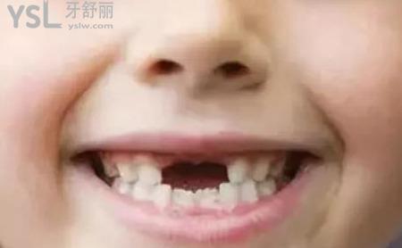牙齒掉了多久能長出來？