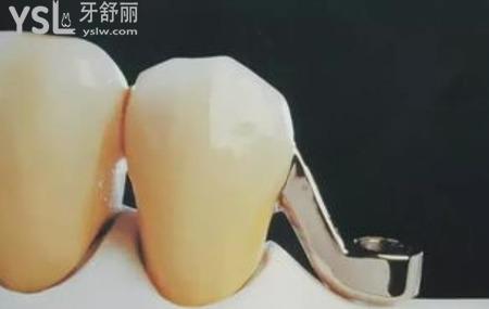夜晚睡覺磨牙怎么回事？
