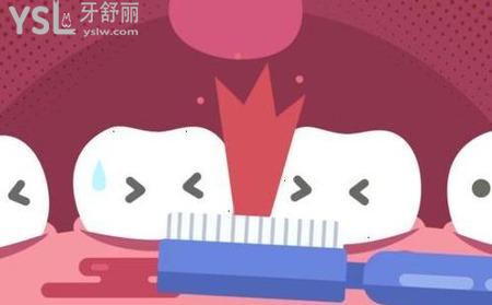 如何判斷自己有牙周炎？