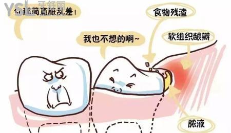 拔智齒后冷敷多長時間？