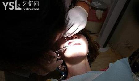 拔智齒花多少錢？到底幾天才好？