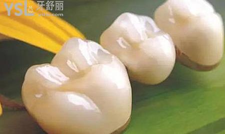 我是該補(bǔ)牙還是做烤瓷牙哪一個(gè)好？