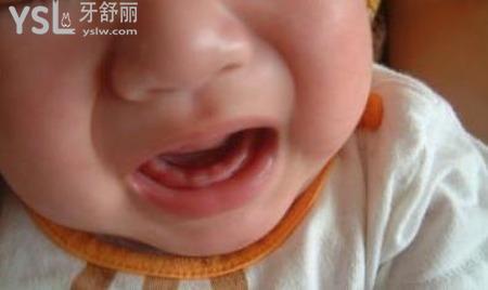 小孩九個(gè)月孩還沒(méi)有長(zhǎng)牙,是什么原因?