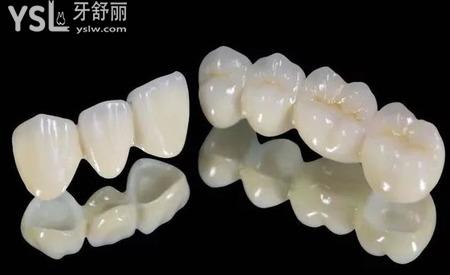 一般的全烤瓷牙多少錢一顆？
