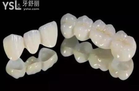 拔牙之后如果不補(bǔ)牙有什么影響？