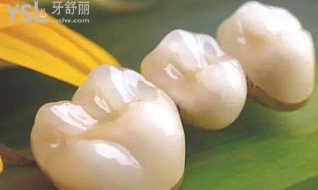 全瓷牙可以洗牙嗎？