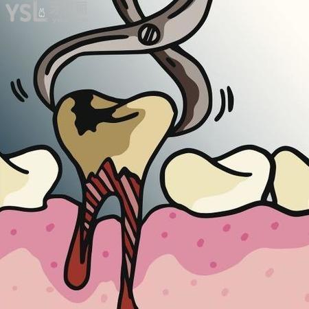 補(bǔ)完牙后牙疼怎么止痛？