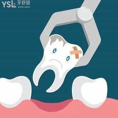 拔牙后需要注意什么事項？