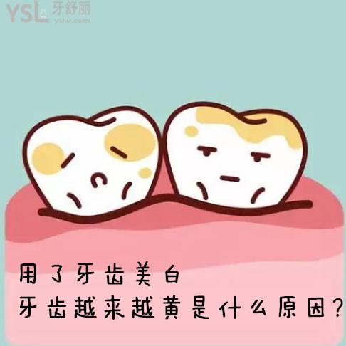 好苦惱！用了牙齒美白牙齒越來越黃是什么原因？