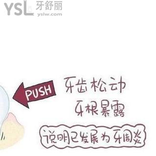為什么總是感覺牙齒有點(diǎn)松動(dòng)？懂的人來說說