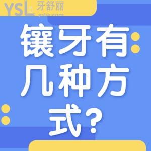 鑲牙有幾種方式?鑲牙要多少錢一顆?