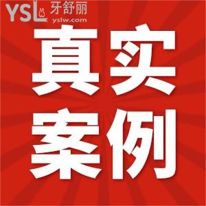 去無錫維樂口腔門診部看牙是怎樣的體驗(yàn)？真實(shí)評價在這里