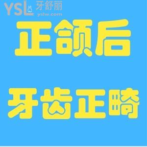 贛州章貢區(qū)能做正頜術(shù)后牙齒正畸的診所是哪里？哪位醫(yī)生能做？求推薦！