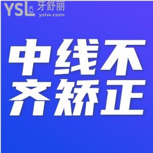 ?牙中線不齊需要矯正嗎？