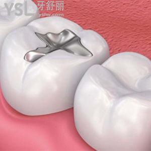 補(bǔ)牙用什么材料較好最牢固？