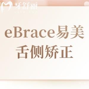 eBrace易美舌側(cè)矯正