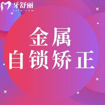 傳統(tǒng)金屬自鎖矯正