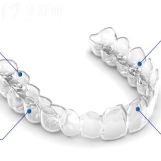 杭州隱秀Hibeauty全隱形牙齒矯治器