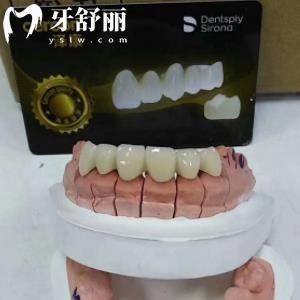 德國澤康氧化鋯全瓷牙