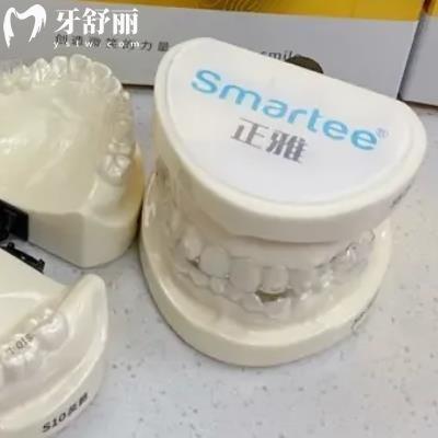 正雅Smartee  Gs定制矯治器