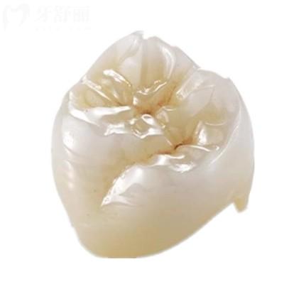 威蘭德ZENOSTAR臻瓷全瓷牙冠